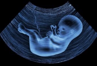 Posição da CNBB: defesa incondicional da vida e contra o aborto